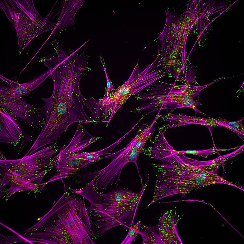 Microphotography of cells, with magenta fibers, green protein and blue nuclei.
